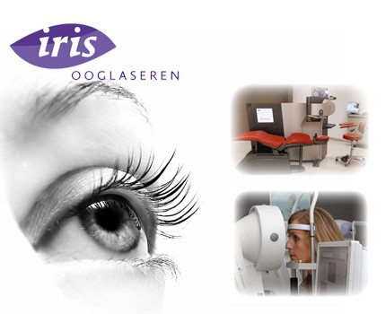 Groupdeal - Een complete ooglaserbehandeling bij Iris Ooglaseren: zeg vaarwel tegen bril of contactlenzen!