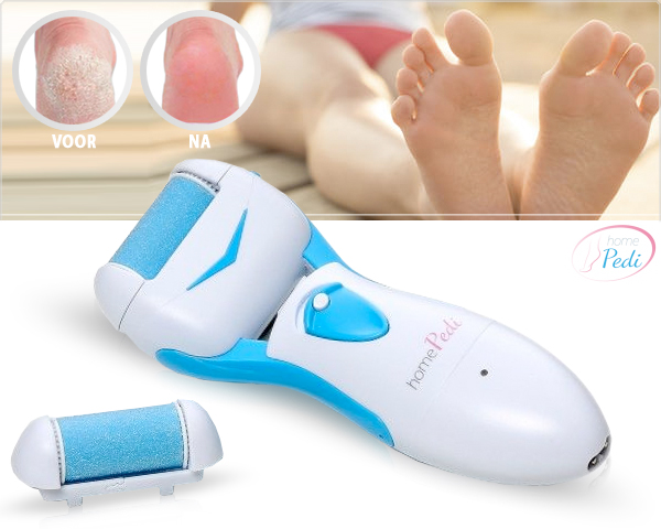 1 Day Fly Lady - Oplaadbare Pedicure Voetvijl Voor Gladde Voeten 1 Day Fly Lady - Oplaadbare Pedicure Voetvijl Voor Gladde Voeten