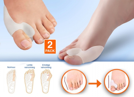 Deal Donkey - Teencorrectors; Corrigeert De Stand Van De Grote Tenen Deal Donkey - Teencorrectors; Corrigeert De Stand Van De Grote Tenen