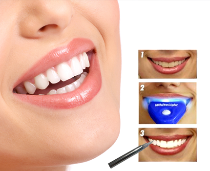 Groupdeal - De WhiteLight met een Whitening bleekpen voor het onderhoud Groupdeal - De WhiteLight met een Whitening bleekpen voor het onderhoud
