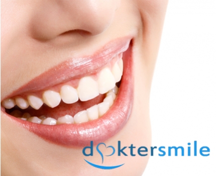 Groupdeal - Tandenbleken bij Dokter Smile Groupdeal - Tandenbleken bij Dokter Smile