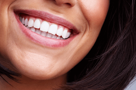 Groupon - € 119 Voor 'N Stralend Witte Glimlach Dankzij De Professionele Tandenbleekmethode Van Thuis Tanden Bleken (Waarde € 249) Groupon - € 119 Voor 'N Stralend Witte Glimlach Dankzij De Professionele Tandenbleekmethode Van Thuis Tanden Bleken (Waarde € 249)